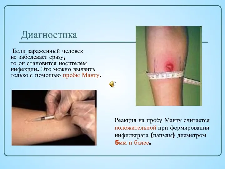 Диагностика Если зараженный человек не заболевает сразу, то он становится носителем