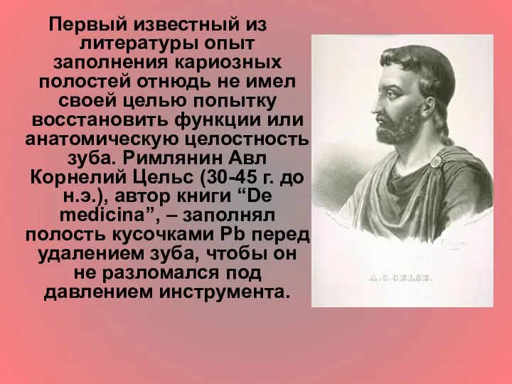 Первый известный из литературы опыт заполнения кариозных полостей отнюдь не имел