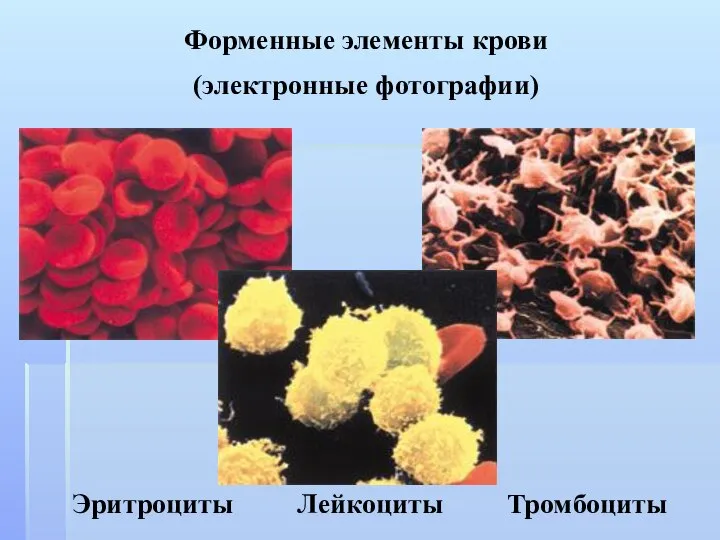 Форменные элементы крови (электронные фотографии) Эритроциты Лейкоциты Тромбоциты