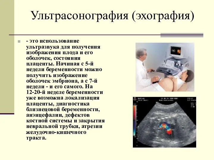 Ультрасонография (эхография) - это использование ультразвука для получения изображения плода и