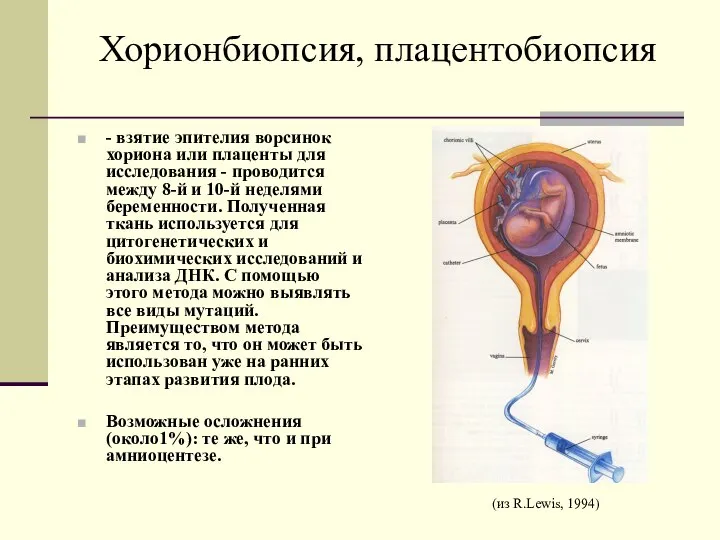 Хорионбиопсия, плацентобиопсия - взятие эпителия ворсинок хориона или плаценты для исследования