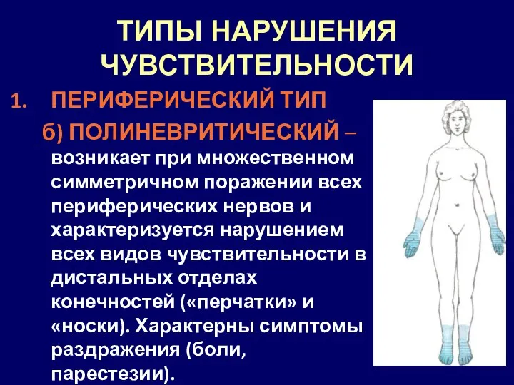 ТИПЫ НАРУШЕНИЯ ЧУВСТВИТЕЛЬНОСТИ ПЕРИФЕРИЧЕСКИЙ ТИП б) ПОЛИНЕВРИТИЧЕСКИЙ – возникает при множественном