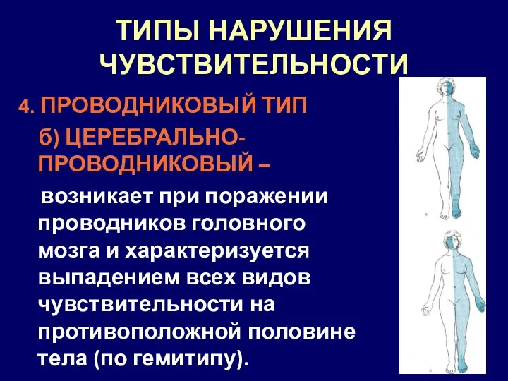 ТИПЫ НАРУШЕНИЯ ЧУВСТВИТЕЛЬНОСТИ 4. ПРОВОДНИКОВЫЙ ТИП б) ЦЕРЕБРАЛЬНО-ПРОВОДНИКОВЫЙ – возникает при