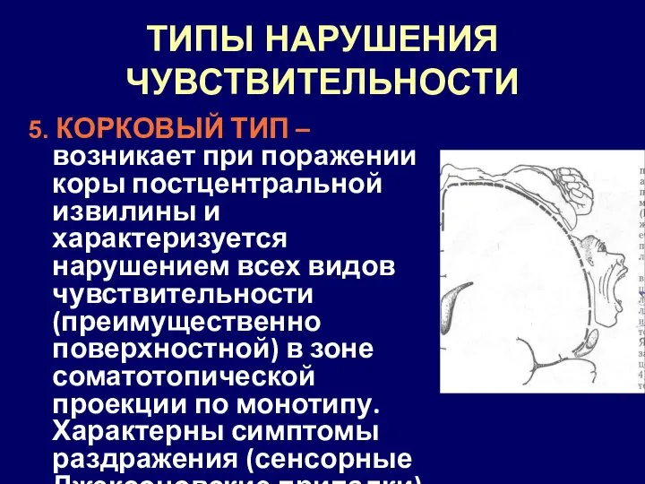 ТИПЫ НАРУШЕНИЯ ЧУВСТВИТЕЛЬНОСТИ 5. КОРКОВЫЙ ТИП – возникает при поражении коры