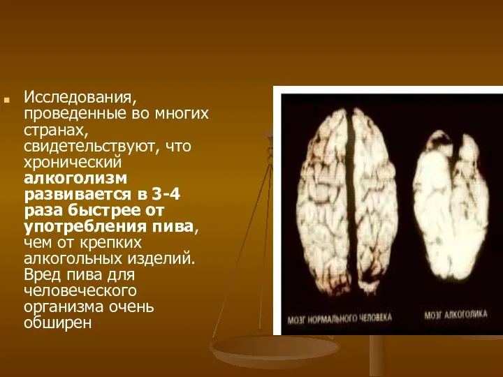 Исследования, проведенные во многих странах, свидетельствуют, что хронический алкоголизм развивается в