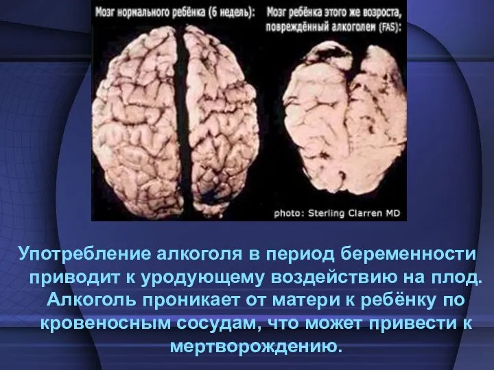 Употребление алкоголя в период беременности приводит к уродующему воздействию на плод.