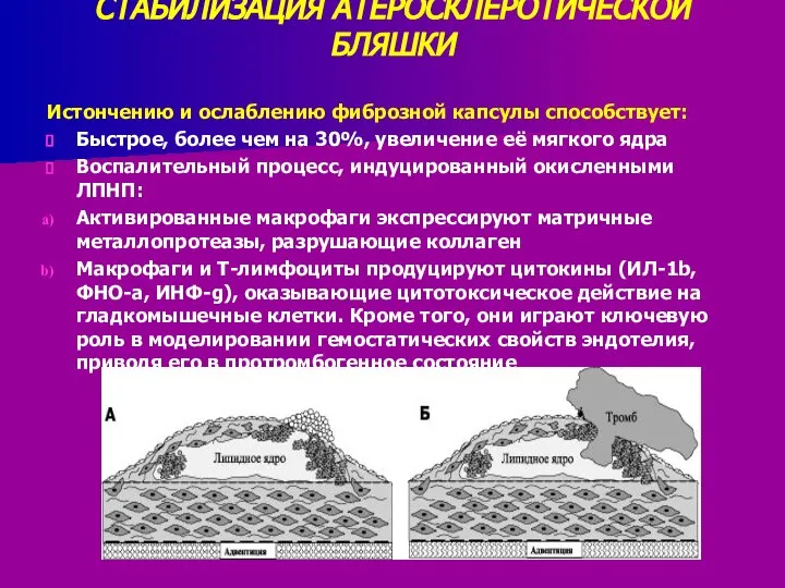 СТАБИЛИЗАЦИЯ АТЕРОСКЛЕРОТИЧЕСКОЙ БЛЯШКИ Истончению и ослаблению фиброзной капсулы способствует: Быстрое, более