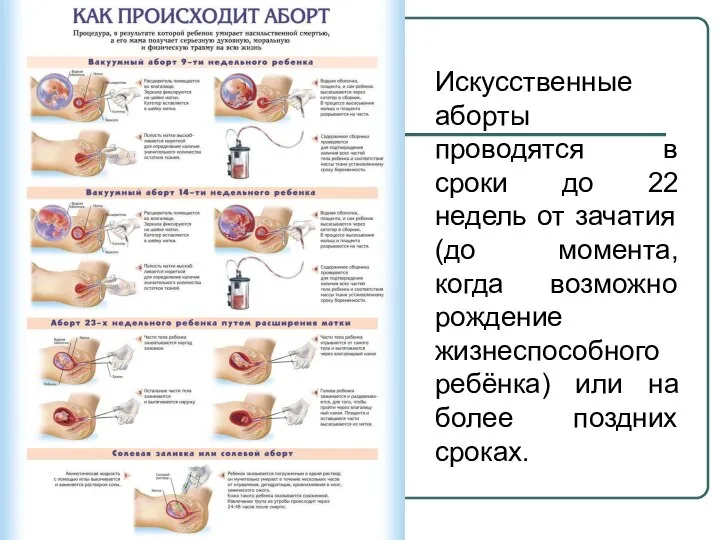 Искусственные аборты проводятся в сроки до 22 недель от зачатия (до