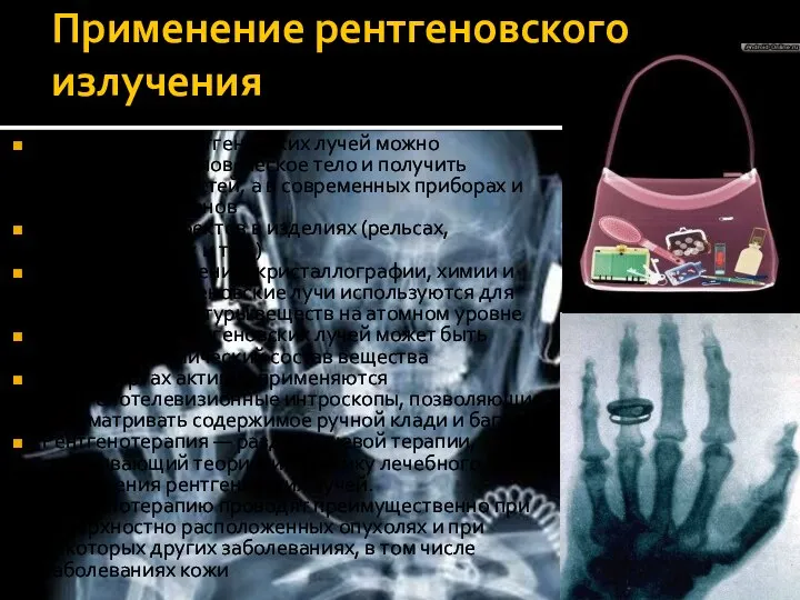 Применение рентгеновского излучения При помощи рентгеновских лучей можно «просветить» человеческое тело