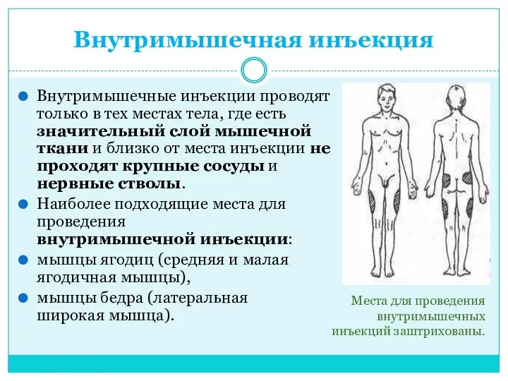 Внутримышечная инъекция Внутримышечные инъекции проводят только в тех местах тела, где