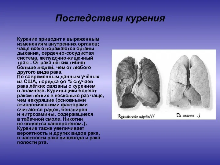 Последствия курения Курение приводит к выраженным изменениям внутренних органов; чаще всего