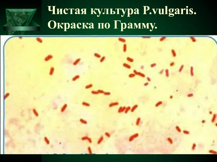 Чистая культура P.vulgaris. Окраска по Грамму.