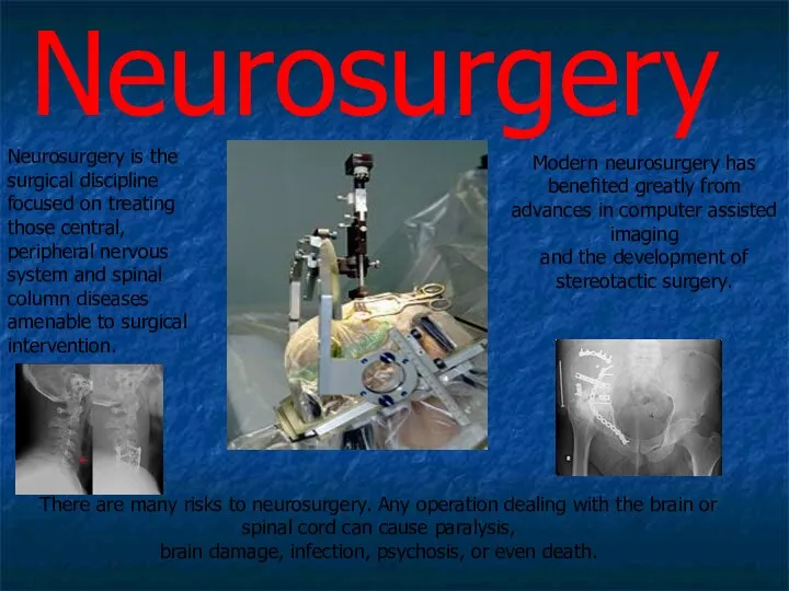 Neurosurgery Neurosurgery is the surgical discipline focused on treating those central,