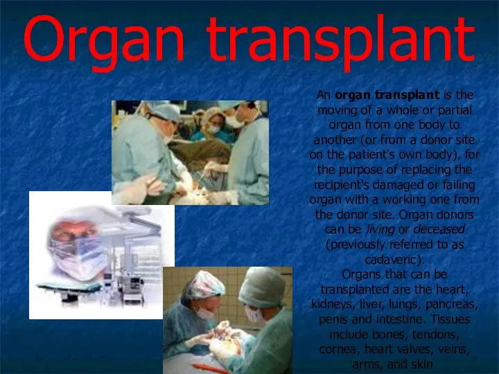 An organ transplant is the moving of a whole or partial