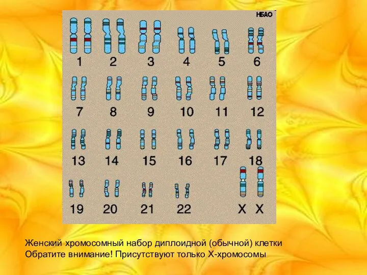 Женский хромосомный набор диплоидной (обычной) клетки Обратите внимание! Присутствуют только X-хромосомы