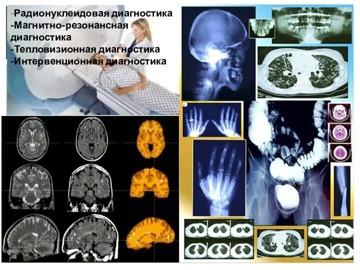 -Радионуклеидовая диагностика -Магнитно-резонансная диагностика -Тепловизионная диагностика -Интервенционная диагностика