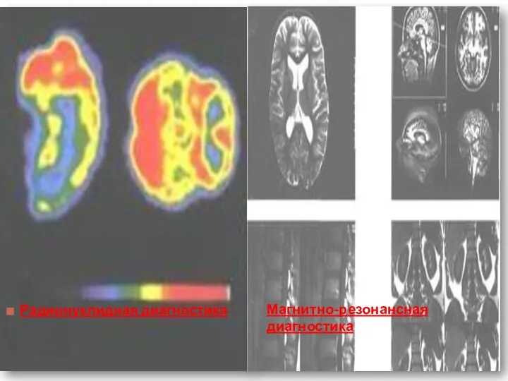 Радионуклидная диагностика Магнитно-резонансная диагностика