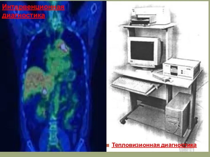 Тепловизионная диагностика Интервенционная диагностика