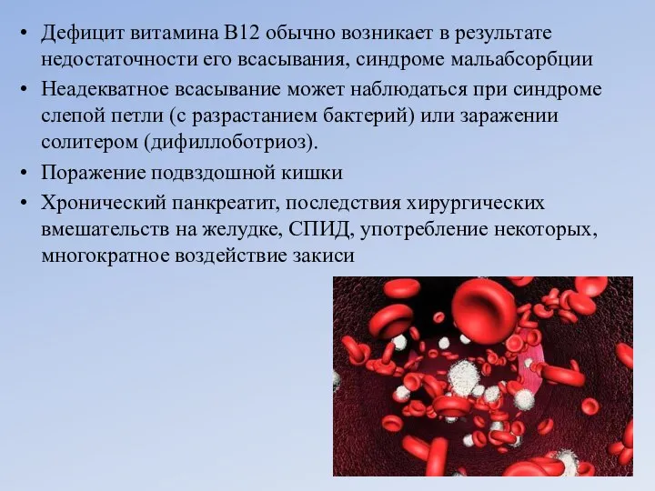 Дефицит витамина B12 обычно возникает в результате недостаточности его всасывания, синдроме