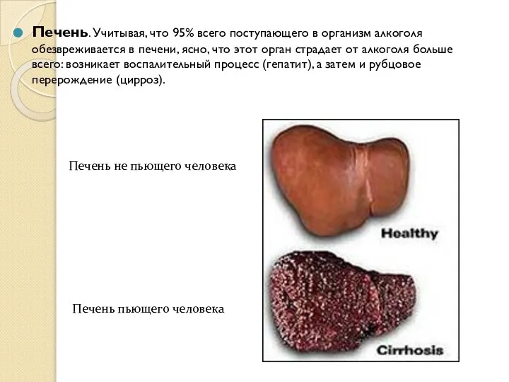 Печень. Учитывая, что 95% всего поступающего в организм алкоголя обезвреживается в