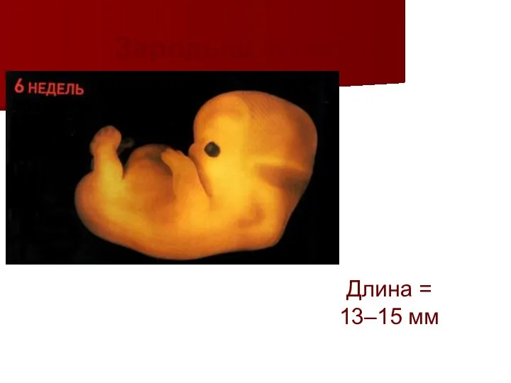 Зародыш, 6 недель Длина = 13–15 мм