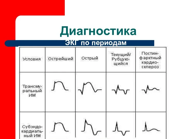 Диагностика ЭКГ по периодам