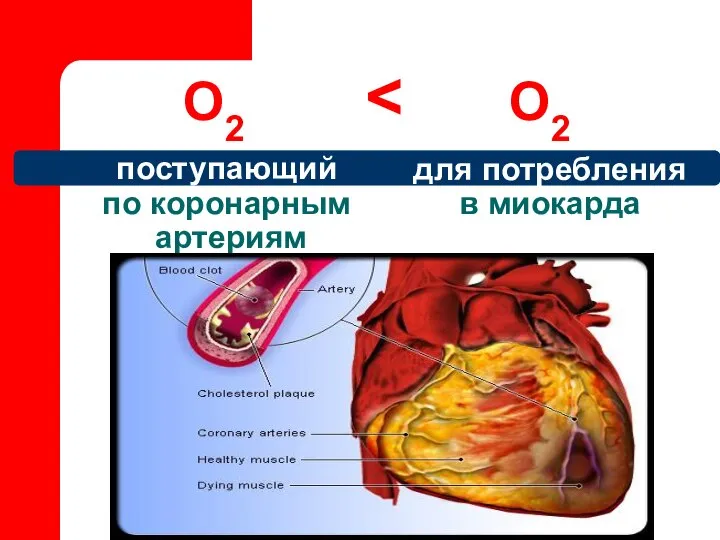 поступающий по коронарным артериям О2 для потребления в миокарда