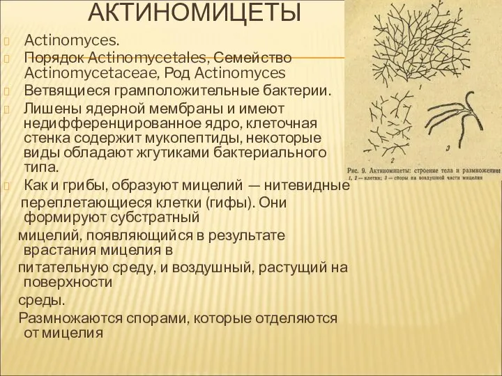 АКТИНОМИЦЕТЫ Actinomyces. Порядок Actinomycetales, Семейство Actinomycetaceae, Род Actinomyces Ветвящиеся грамположительные бактерии.