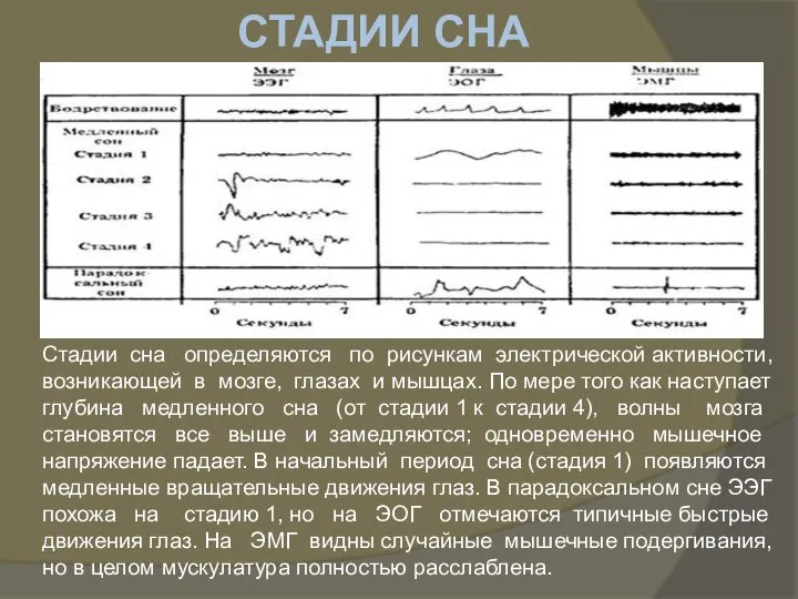 Стадии сна определяются по рисункам электрической активности, возникающей в мозге, глазах