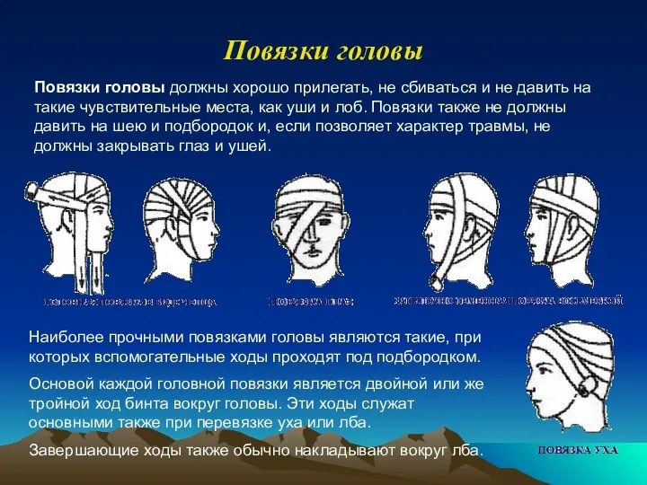 Повязки головы Повязки головы должны хорошо прилегать, не сбиваться и не