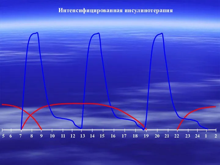 Интенсифицированная инсулинотерапия 5 6 7 8 9 10 11 12 13