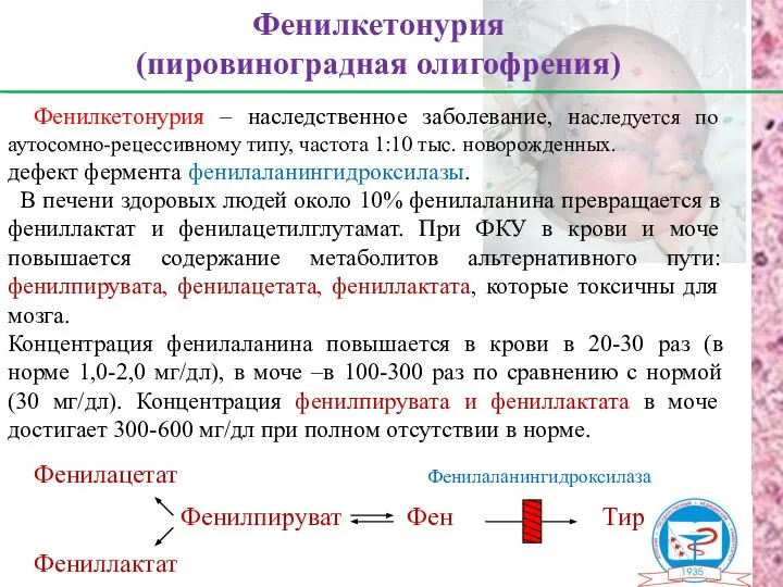 Фенилкетонурия – наследственное заболевание, наследуется по аутосомно-рецессивному типу, частота 1:10 тыс.