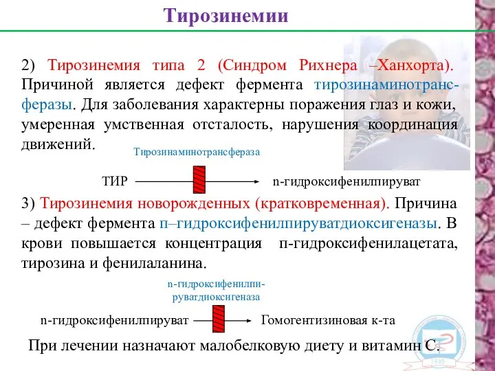 2) Тирозинемия типа 2 (Синдром Рихнера –Ханхорта). Причиной является дефект фермента