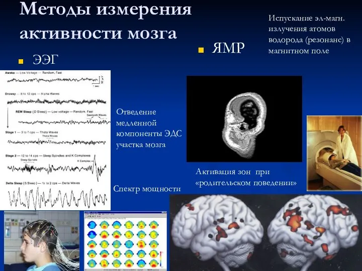 Методы измерения активности мозга ЭЭГ ЯМР Отведение медленной компоненты ЭДС участка