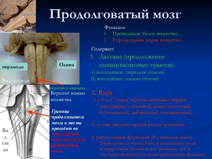 Продолговатый мозг Вид сзади Граница продолговатого мозга и моста проходит по