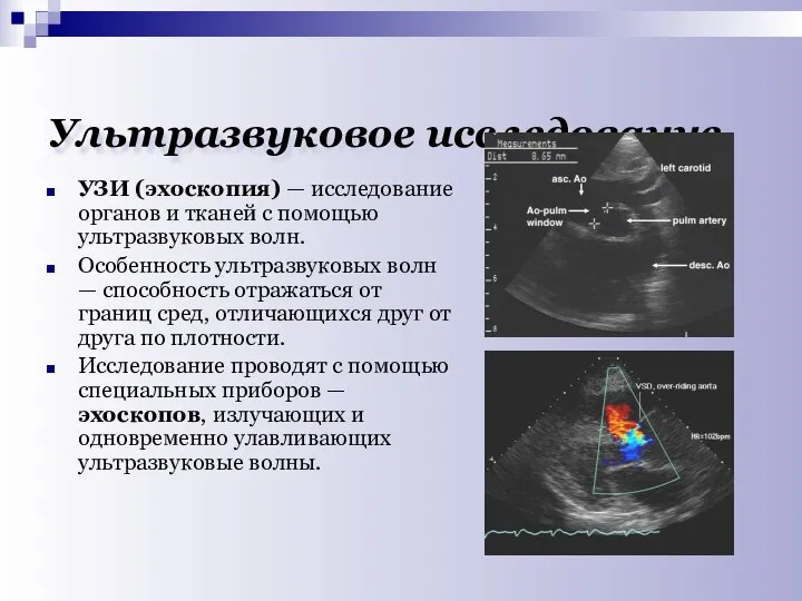 Ультразвуковое исследование УЗИ (эхоскопия) — исследование органов и тканей с помощью