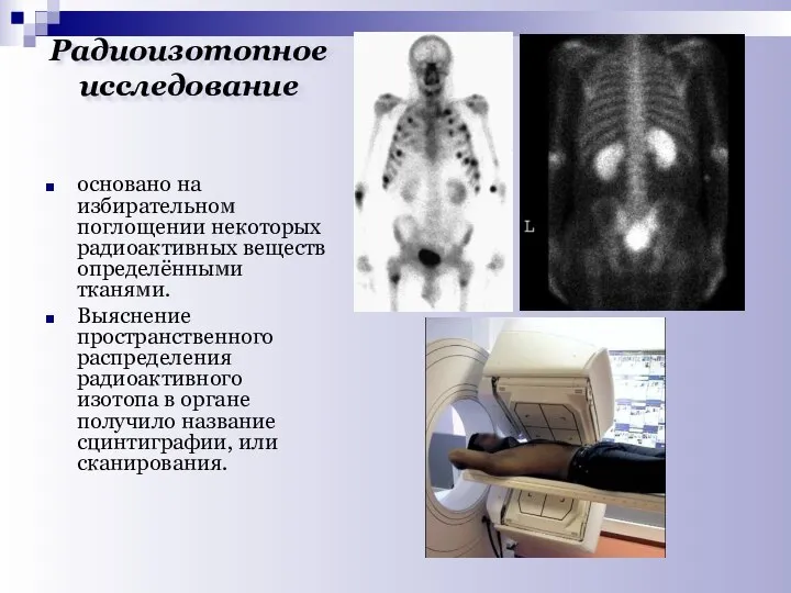 Радиоизотопное исследование основано на избирательном поглощении некоторых радиоактивных веществ определёнными тканями.