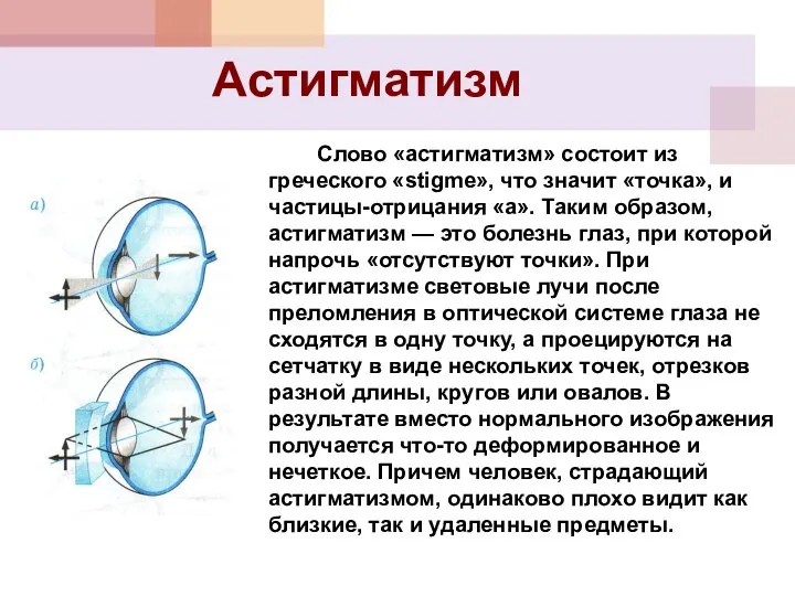 Астигматизм Слово «астигматизм» состоит из греческого «stigme», что значит «точка», и