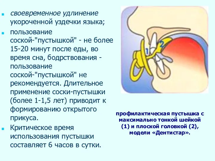 своевременное удлинение укороченной уздечки языка; пользование соской-"пустышкой" - не более 15-20