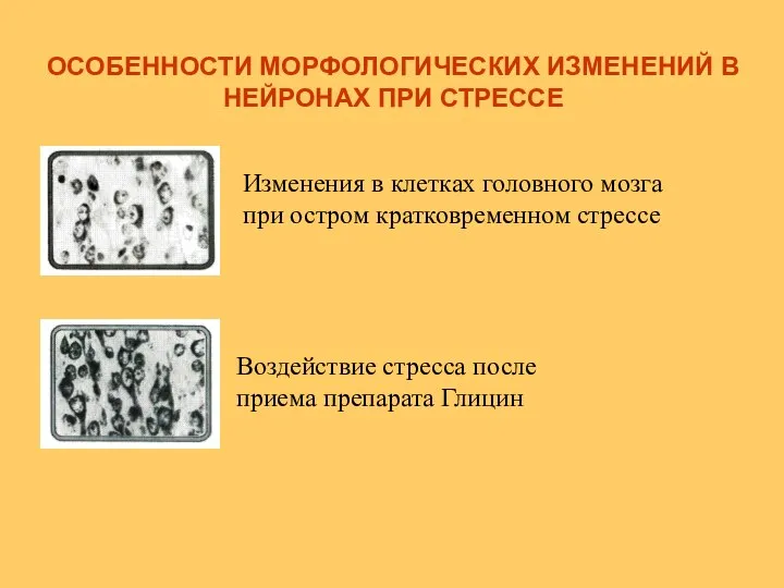 ОСОБЕННОСТИ МОРФОЛОГИЧЕСКИХ ИЗМЕНЕНИЙ В НЕЙРОНАХ ПРИ СТРЕССЕ Воздействие стресса после приема