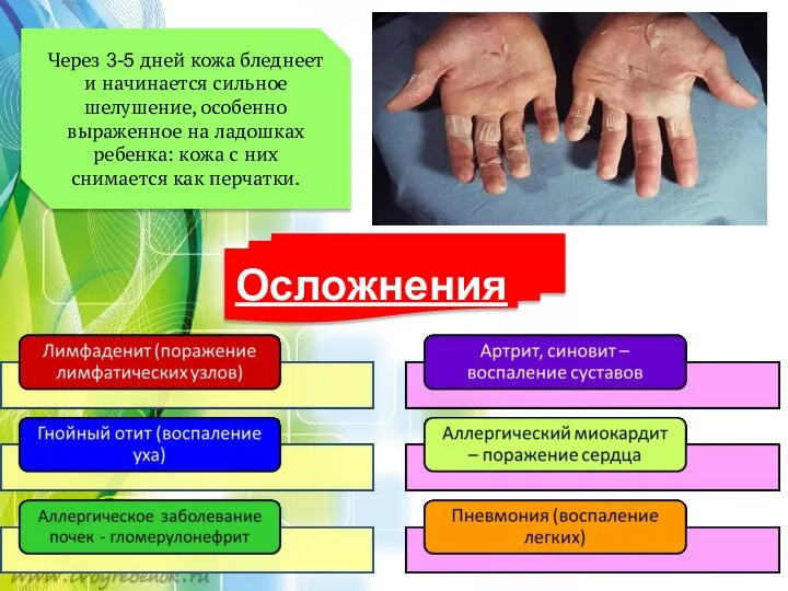 Через 3-5 дней кожа бледнеет и начинается сильное шелушение, особенно выраженное