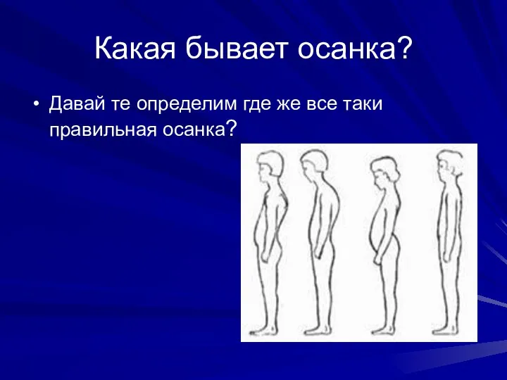 Какая бывает осанка? Давай те определим где же все таки правильная осанка?