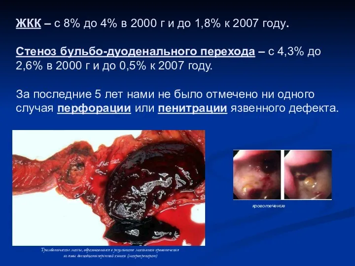 ЖКК – с 8% до 4% в 2000 г и до