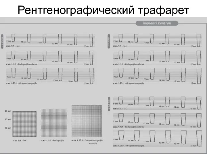 Рентгенографический трафарет