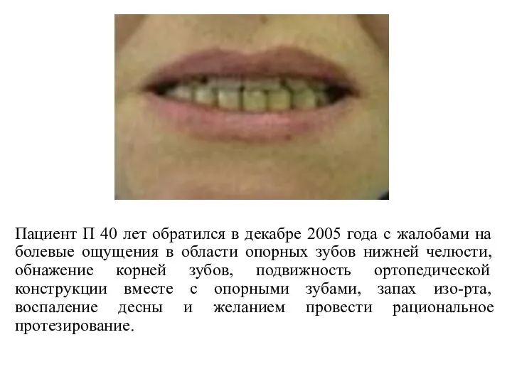 Пациент П 40 лет обратился в декабре 2005 года с жалобами