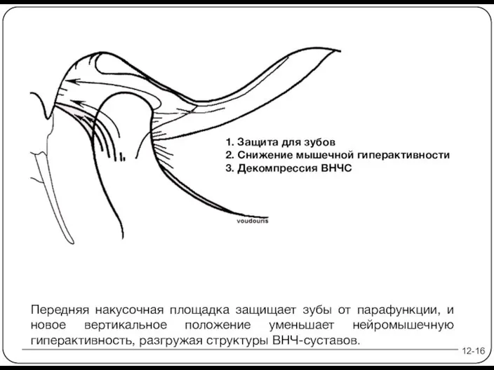 12-16 1. Защита для зубов 2. Снижение мышечной гиперактивности 3. Декомпрессия