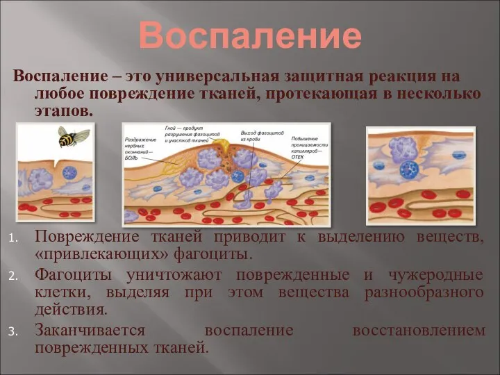 Воспаление Воспаление – это универсальная защитная реакция на любое повреждение тканей,