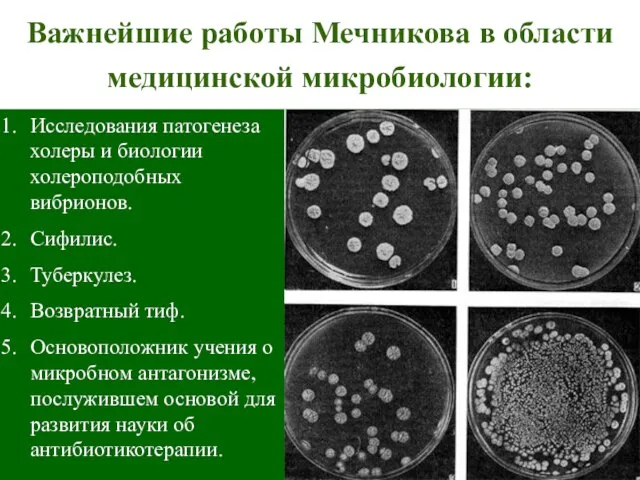 Важнейшие работы Мечникова в области медицинской микробиологии: Исследования патогенеза холеры и