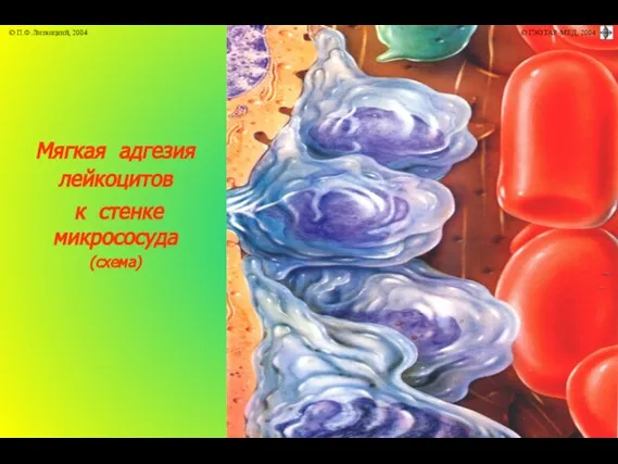 Мягкая адгезия лейкоцитов к стенке микрососуда (схема)