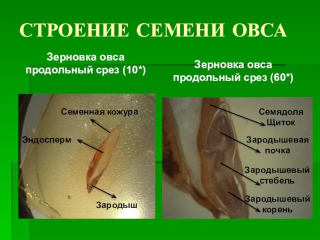 СТРОЕНИЕ СЕМЕНИ ОВСА Зерновка овса продольный срез (10*) Зерновка овса продольный